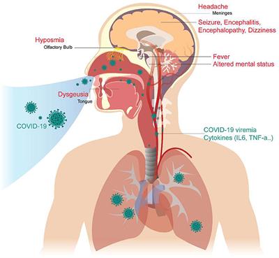 The Neurologic Manifestations of Coronavirus Disease 2019 Pandemic: A Systemic Review